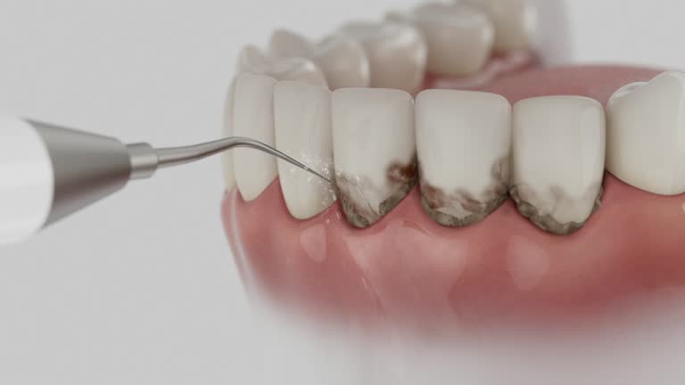 Trusted Wisdom Tooth Removal service in Oakdale, PA - Dentist Open Now